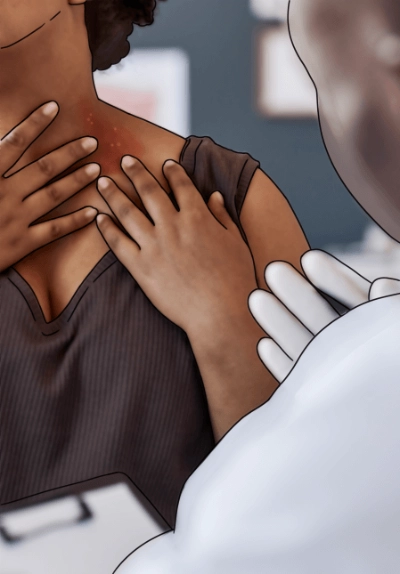 Asesoría médica con un doctor por dermatitis atópica